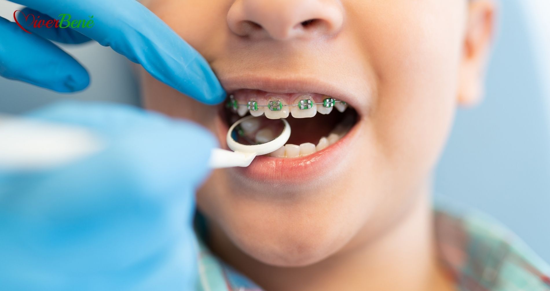 Malocclusione dentale: perché è importante correggerla fin da piccoli